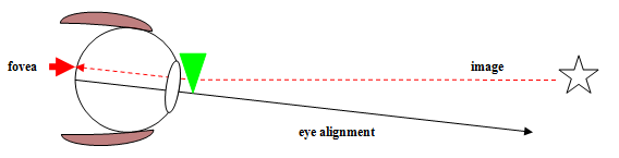 Diagram 4 - BVD - Visual description of Binocular Vision disorder