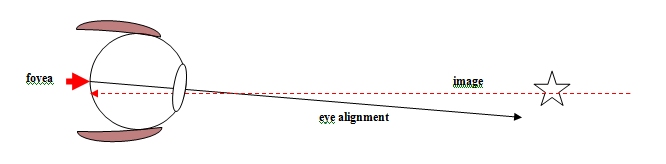 Diagram 1 - BVD - Visual description of Binocular Vision disorder